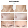 EMS facelift device Jane