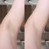 IPL hair remover Aura Pro