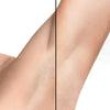 IPL hair remover Aura Pro