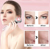 Nuri EMS facial massager
